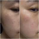 태극약국 | 태극제약 도미나크림 | 한 달 사용 후기, 내돈내산 리뷰