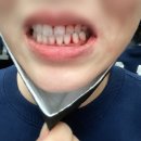 로고스치과의원 | ✔임플란트 잘하는 치과! 광고없이 입소문으로 유명한 치과, 교대역의 "화이트플란트치과"에서 잇몸치료...