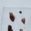 고운가이드치과병원 이미지