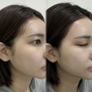 GS25연수단비점 | 💗💗옥련동왁싱 왁싱이즈 페이스왁싱후기 👸🏻💗💗