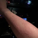 가산의료재단광동병원 | 서울아토피 병원 알레르기 명의 진료 무엇이 달랐을까