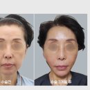 윤은성성형외과의원 | 청담에서 찾은 진짜 안면거상 명가들 – 자연스럽고 확실한 변화의 시작