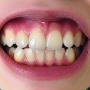 365아홉가지약속치과병원 | 아산치과 365아홉가지약속치과병원 치아여행