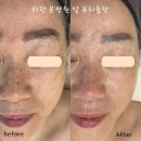 사하구-60 네이버블로그