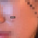 데이뷰의원 | 여의도 데이뷰의원 후기(여드름염증주사, 여의도 염증주사 가격,여의도 피부과 의원, 데이뷰 주차)