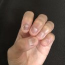 물어뜯는 손톱 교정 후기 / 손톱 연장 잘하는 장기동 네일샵 &#39;네일슈슈&#39;