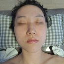 은서 피부관리