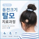 이승철피부과의원 | 7살 아이 머리에 동전 크기 탈모,,머리가 다시 날까?[전대병원 소아 원형탈모 진단,치료후기]