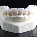 개금진치과의원 | 3D CT 진단과 과잉진료 없는 신뢰 가득한 부산 치과 추천