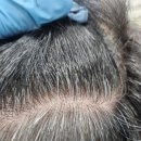 엘샤론 | 안산 엘샤론 염색&amp;네일 사동점 남자 새치염색 후기