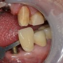 이천치과기공소 이미지