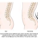 대퇴직근(Rectus femoris)이야기 이미지