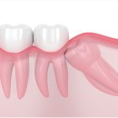 하양탑치과 이미지