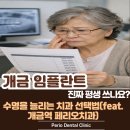 미소심는치과의원 | 개금 임플란트, 진짜 평생 쓰나요? 수명 늘리는 치과 선택법(feat. 개금역 페리오치과)