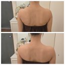 에덴케어 | 근육통 통증관리 / 하체부종관리 안산바디관리 맛집 에덴 스킨케어 추천해요 (후면관리 후기)