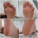 이마트24 울산동평점 | 울산 달동제목없음패디 플래닝제목없음발 각질제거제목없음할인 이벤트 중! 로즐리뷰티