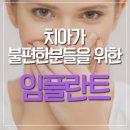 청주치과중, 임플란트 제대로 할 수 있는곳! 이미지