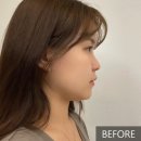 라인팩토리 | 페이스팩토리 링크샷 리프팅 뷰티 디바이스 내돈내산 후기