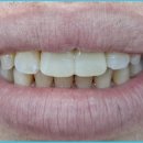 다치과기공소 이미지