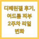 (주)고려텍미디어 | 디페린겔 후기, 여드름 피부 2주차 리얼 변화