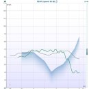 나눔메디칼 | [나눔보청기 사례]거부감이 심하셨던 고객 사례