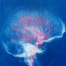 연세나은신경과의원 이미지