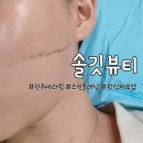 전주 3세대 스킨플래닝 세라링 &lt;솔깃뷰티&gt;에서 받은 후기!