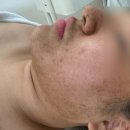 102 | 성연 피부관리 [로엔에스테틱 서산점] 해초필 관리 받고 왔어요~ (탈각까지 찐 후기 맨아래 사진있어요)