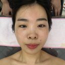 더(The)예쁨뷰티 | [천왕 피부관리] 오늘 the 예쁨 - 물광 필링으로 완성한 웨딩 촬영용 반짝반짝해진 피부 후기