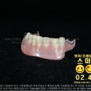 스마일기공소 이미지