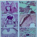 눈흡충 Dipolostomum pseudospathacecum의 무지개송어 중추신경계(CNS)로 이동 이미지