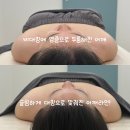 대구 두류동에스테틱 아프지 않은 윤곽관리 오나에스테틱 내돈내산 후기