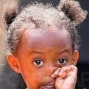 알레르기 이미지