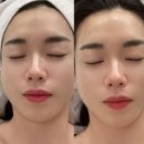레포소