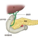 췌장·담도 수술 환자의 퇴원 후 주의사항 이미지