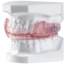 스타치과기공소 이미지