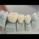 치아사랑치과기공소 이미지