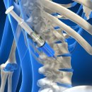 척척신경외과의원 이미지