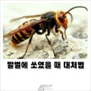 생활정보ㅡ산행시응급처치 (벌. 뱀. 풀독)요령 ㅡ말벌에 쏘였을때ㅡ 이미지