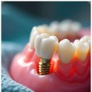 불당본점서울비디치과의원 이미지