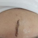 [스무살에머물다 수원스타필드점] 수원피부관리 &#34;스킨 플래닝&#34;으로 보들 반짝 얼굴 만들기!
