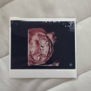 31140-14-20-12 | [공지] [#4] 임신 12주,13주,14주차/1차 기형아검사/니프티검사/젠더리빌/먹덧 임산부