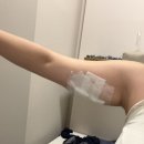 원클리닉의원 | 신사 지방분해주사 1회차, 하프하게 팔뚝살빼기 비만클리닉의원 변화 후기