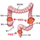 대장 이미지