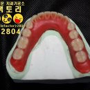 스마일기공소 이미지