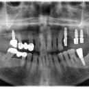 엄윤섭구강악안면외과치과의원 이미지