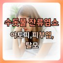 서일유치원 | 수돗물 잔류염소 완벽 제거! 수도계량필터 계량기필터 설치 전문 (아토피, 피부염, 탈모, 민감성피부...