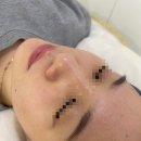 양을로 | 목포 스킨플래닝 잘하는 곳 각질부터 톤까지 한 번에 711뷰티 세라링 관리 후기