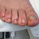 레푸스 남포점 네일포시즌 이미지