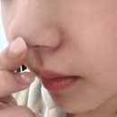 세보 | [제품리뷰]피지연화제 찾다가 결국 정착...! 아클레온 세보 엑스로션 리얼 사용 후기,가격,정보